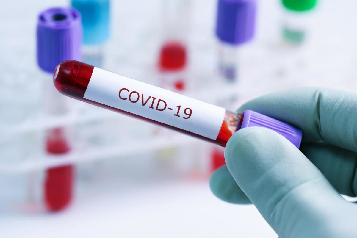 casos de coronavirus COVID-19 en Michoacán [26 DE MARZO]