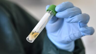 Sube a 10 casos de coronavirus COVID-19 en Michoacán [24 DE MARZO]