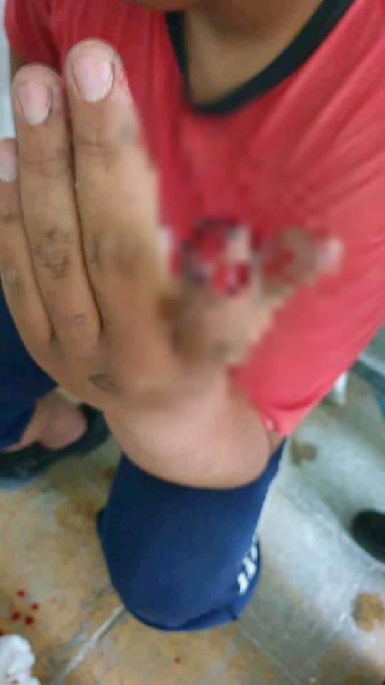 Joven se amputa un dedo en tortillería de Michoacán