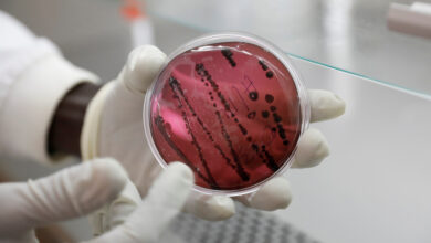 VIRUS CHAPARE: Nuevo virus letal similar al Ébola