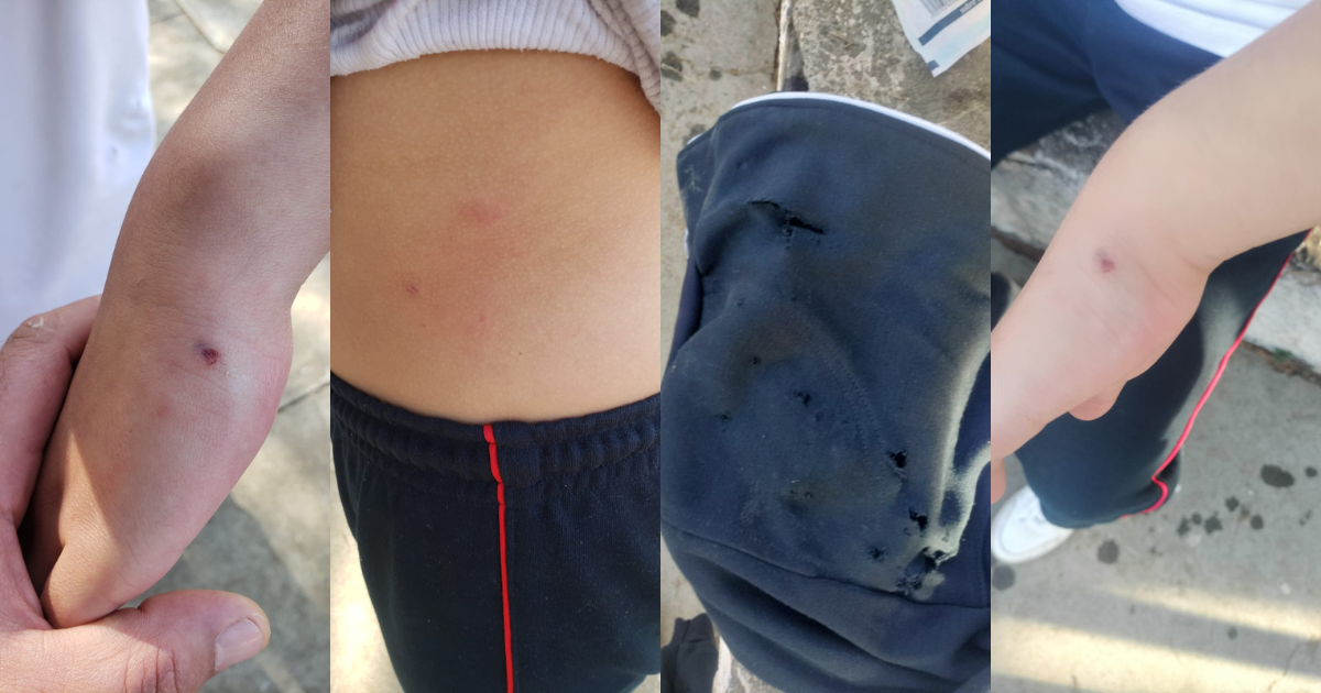 Perrito lesiona a niñas de primaria en Pátzcuaro